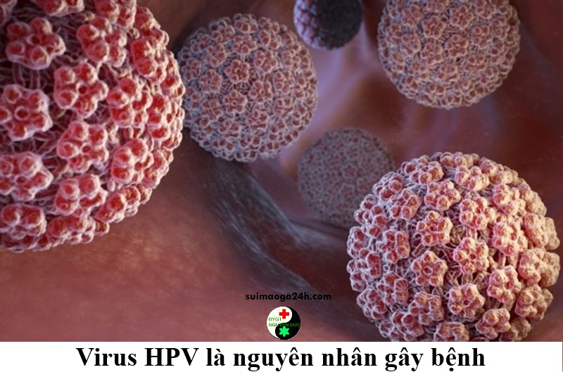 Virus HPV là nguyên nhân gây bệnh sùi mào gà