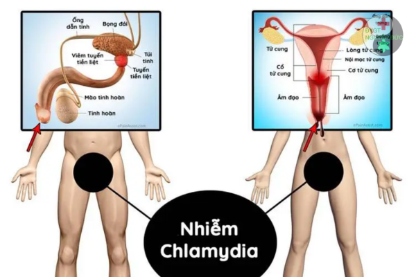 Cách nhận biết nhanh bệnh Chlamydia ở cả nam và nữ (2)