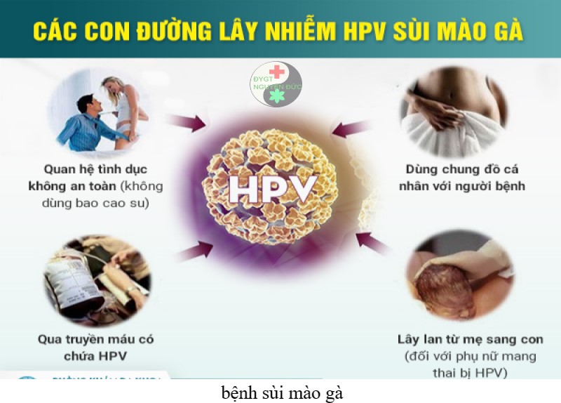 Các con đường lây nhiễm sùi mào gà HPV