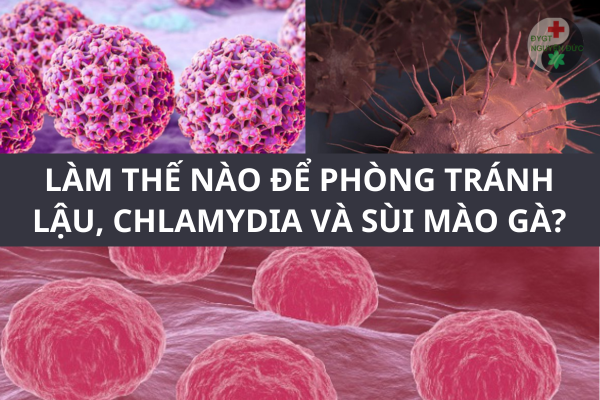 Làm thế nào để phòng tránh bệnh Lậu, Chlamydia và Sùi mào gà (1)