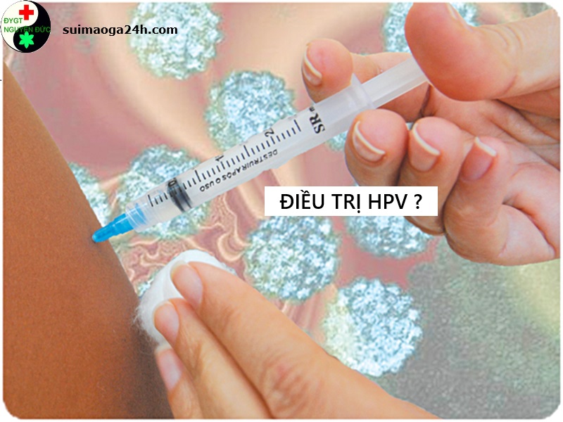 Điều trị HPV