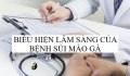Biêu hiện lâm sàng bệnh sùi mào gà