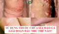 Sử dụng thuốc chữa sùi mào gà giai đoạn đầu như thế nào?