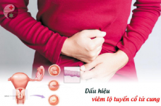 Bệnh viêm lộ tuyến tử cung: Những thông tin hữu ích cần thiết mà bạn cần phải biết