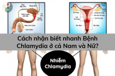 Cách nhận biết nhanh bệnh Chlamydia ở cả nam và nữ