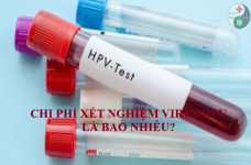 Chi phí xét nghiệm virus HPV là bao nhiêu?