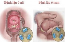 Thuốc chữa bệnh lậu